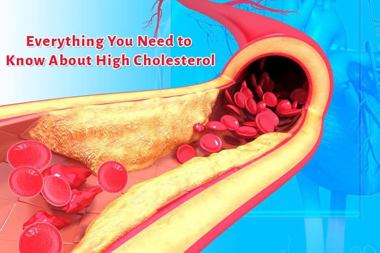 Everything You Need to Know About High Cholesterol