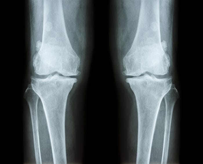 AdobeStock 113447613