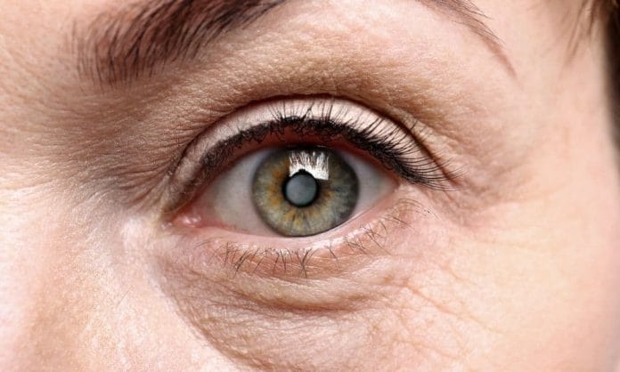 Most Common Geriatric Eye Diseases