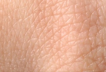 All You Need to Know About Thin Skin: Treatment, Causes, Symptoms, Prevention 2 Texture of human skin, closeup