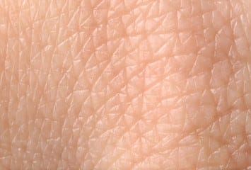 Texture of human skin, closeup