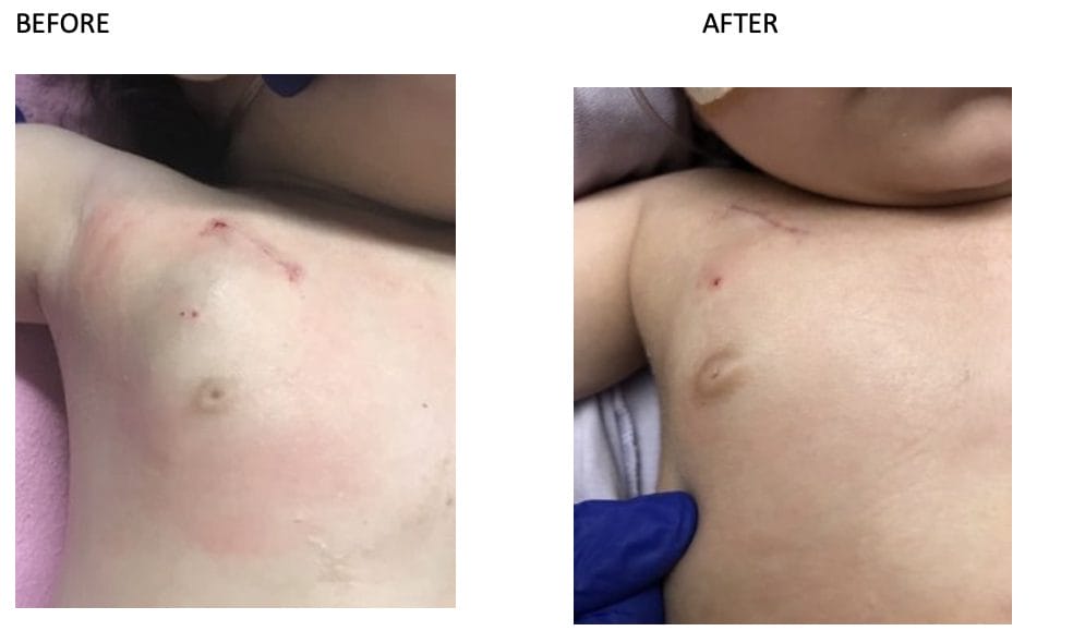 Beyond the Surface: The Unspoken Trauma of Medical Dressings That Cause Harm 2 Screenshot 2023 09 01 at 8.30.41 AM