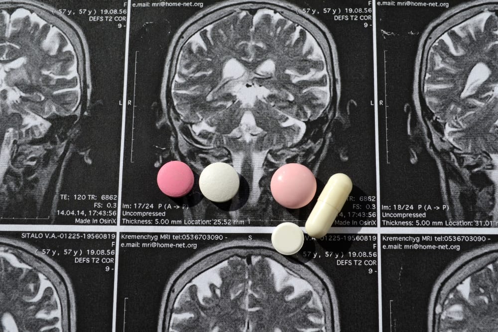 natural nootropics today