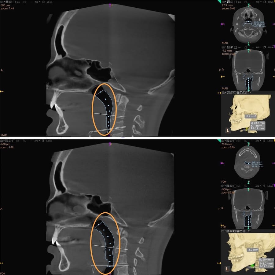 Figure 13